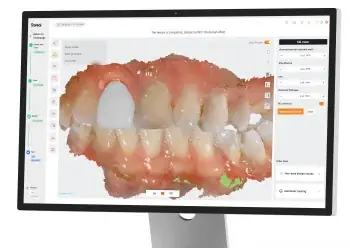 AI CAD proposing a crown in the scan