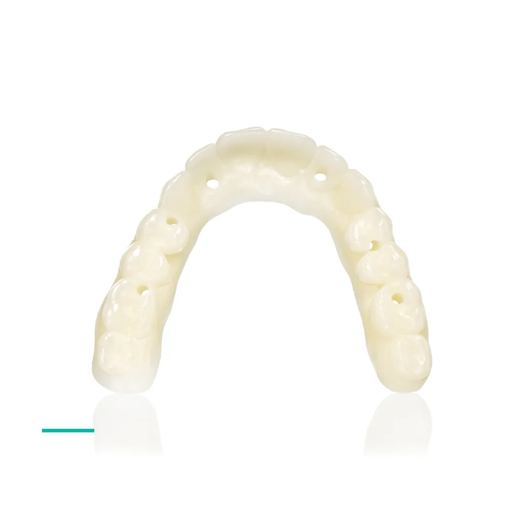 KeyDentureTryIn_02.webp